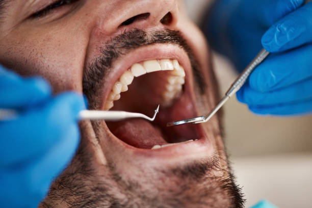 Best Same-Day Emergency Dental Services in Friona, TX