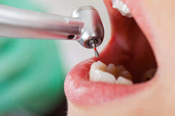 Best Same-Day Emergency Dental Services in Friona, TX